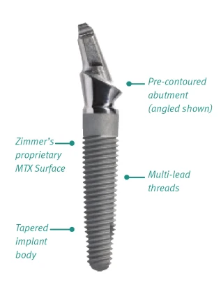 Zimmer One-Piece Implant