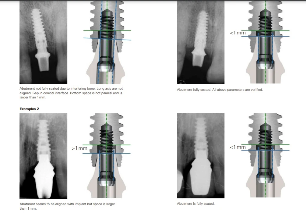 thumbnail image 2 of AG Titanium Healing Abutment 2.25mm Conical Connection - Compatible With Nobel Active (Narrow Platform, Multiple Heights) 2 of 6