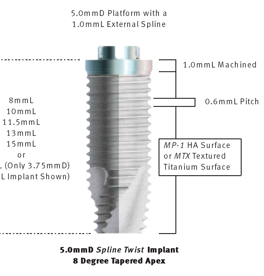 dental implant - Zimmer Dental - Spline Twist (5.0) - Root Form ...